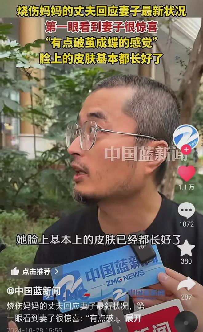 半岛·综合体育入口烧伤妈妈最新情况曝光！丈夫惊喜：脸部皮肤基本长好！(图1)